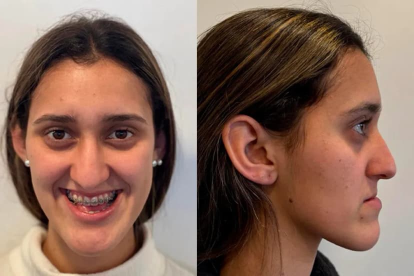 Cirugía Maxilofacial - Before