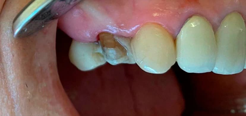 Urgencias y Resoluciones en el día - Before