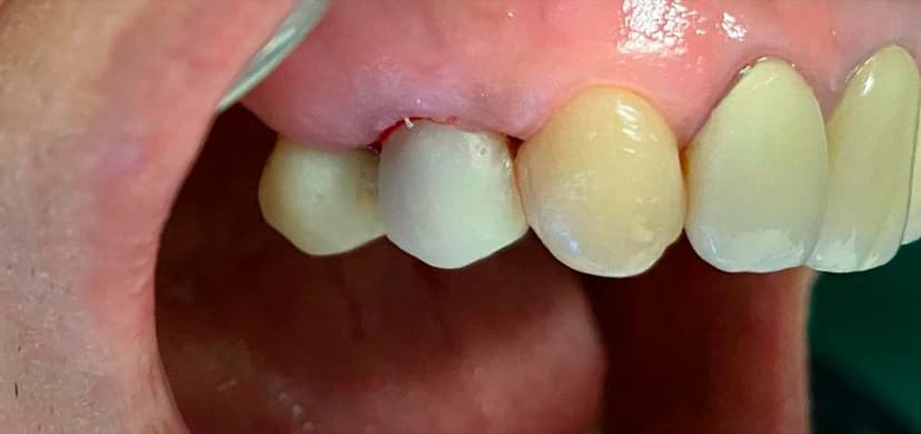 Urgencias y Resoluciones en el día - After