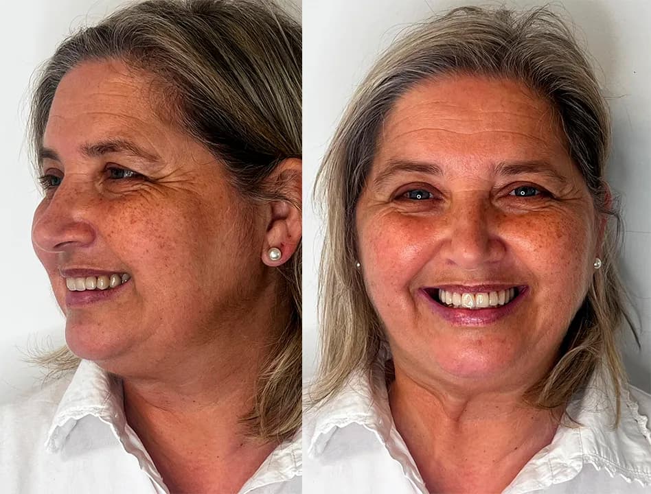 Yenny y su nueva sonrisa - Image 1